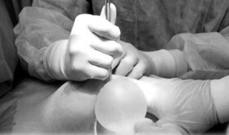 Nguy cơ và biến chứng khi tiêm filler cần biết — ai không nên làm?