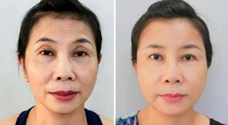 Nên chọn theo tiêu chí nào?