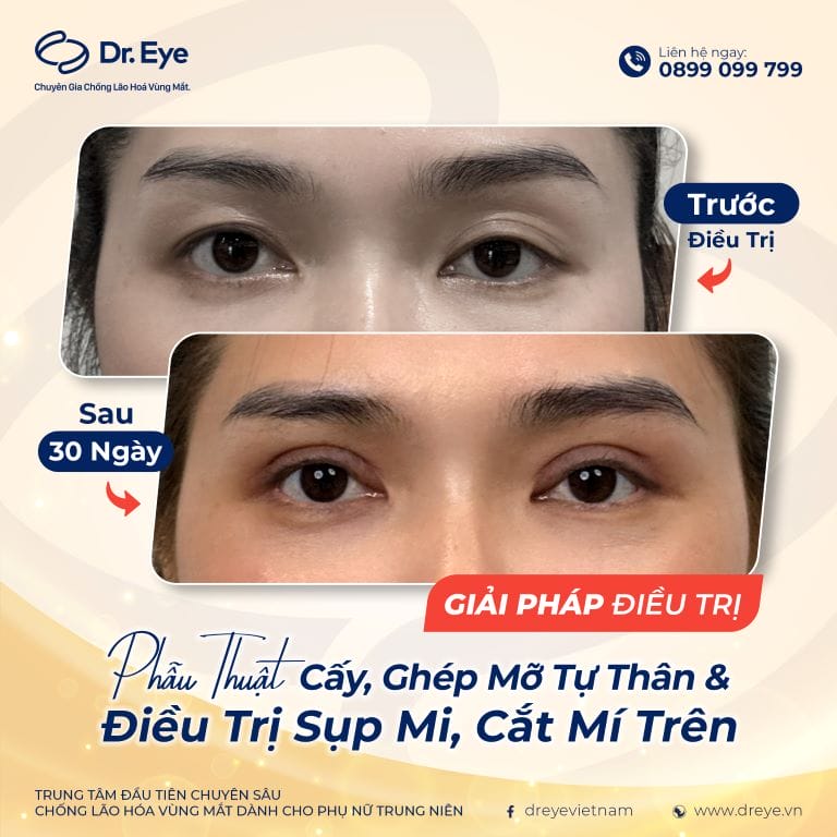 Các giải pháp phối hợp có thể tăng hiệu quả thẩm mỹ là gì?