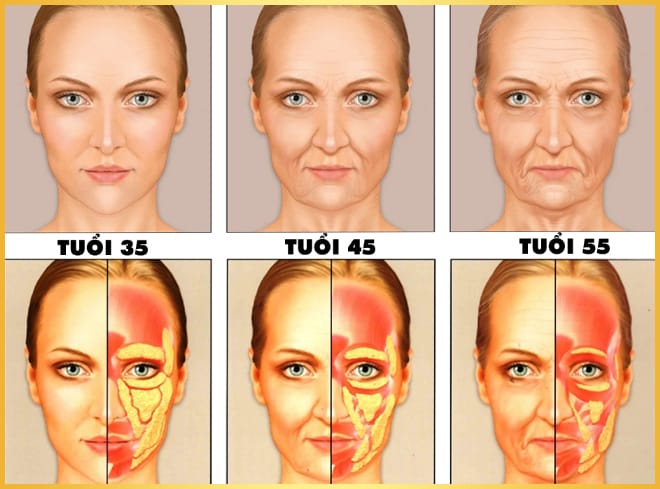 Cấy mỡ mặt xong: sưng khi nào bớt và thời gian hồi phục