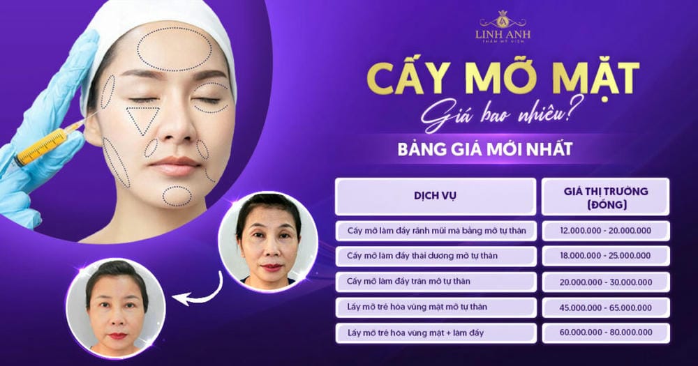Mỗi loại mỡ (microfat, nanofat, SVF) phù hợp với vùng nào?