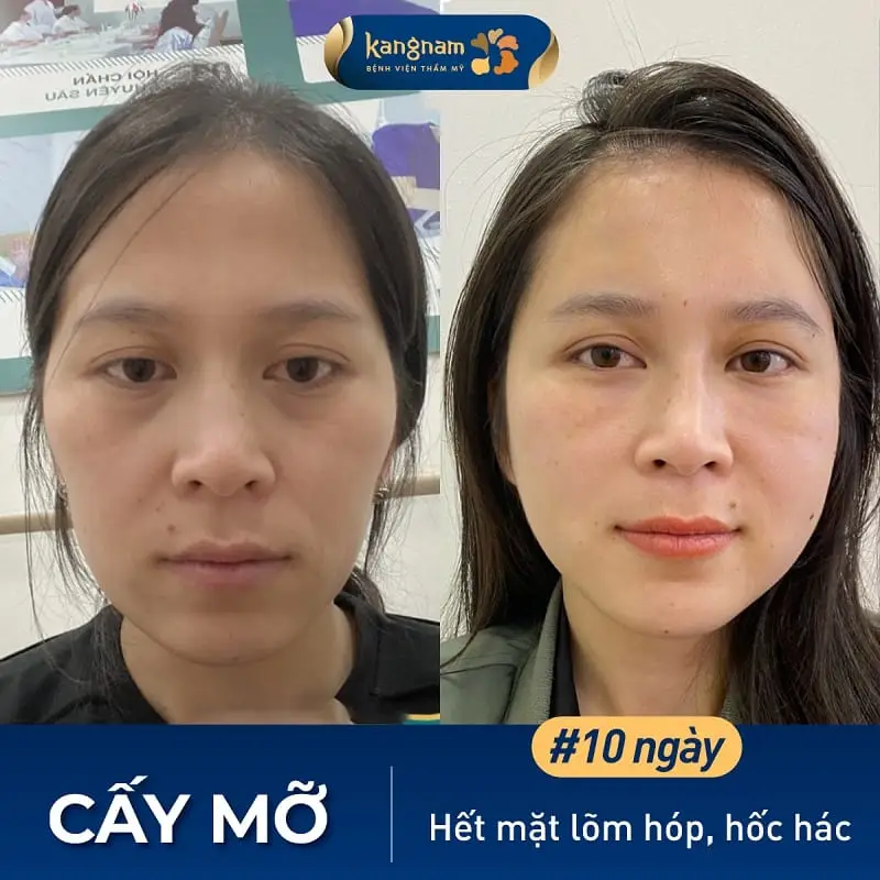 Chi phí có phải là yếu tố quyết định chất lượng — làm sao cân bằng ngân sách và an toàn?