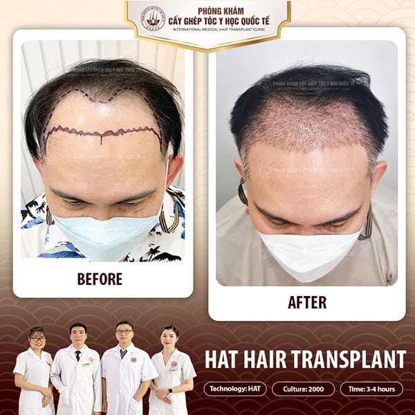 So sánh nhanh để chọn lựa