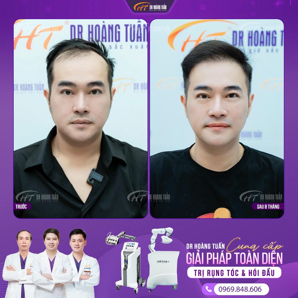Nguy cơ, tác dụng phụ và khi nào không nên cấy?