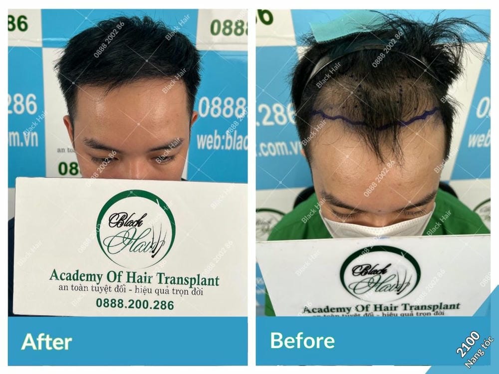 Điểm khác biệt thực tế cần biết