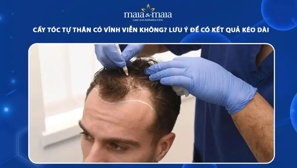 Bằng chứng tóm tắt và lời khuyên trước khi quyết định
