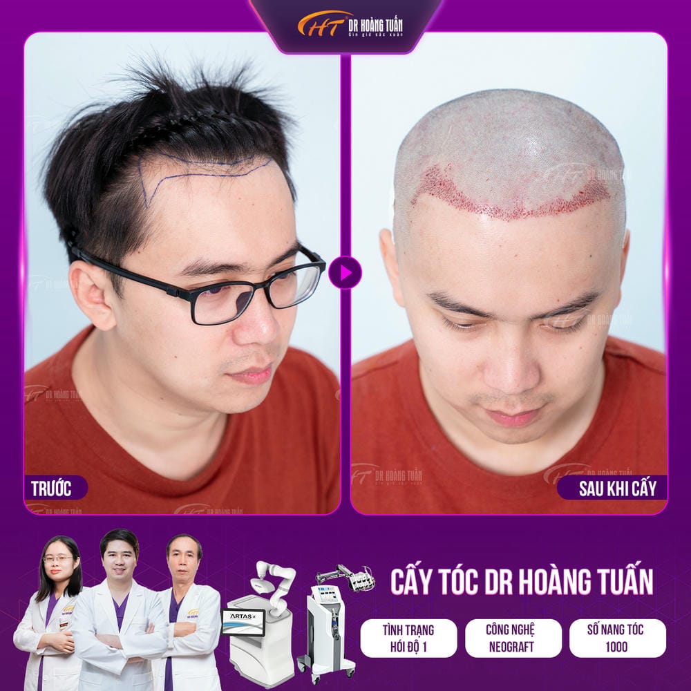 Bảng so sánh ngắn: ưu — nhược của các lựa chọn theo mục tiêu
