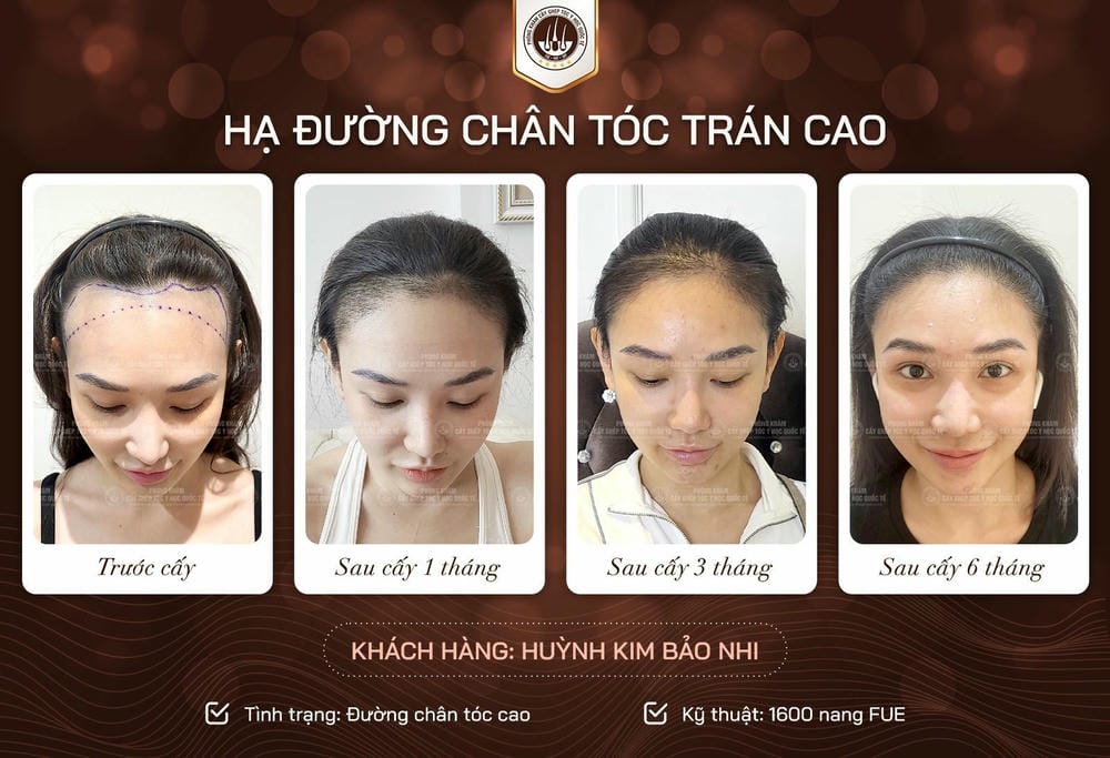 Chi phí được tính theo những yếu tố nào?