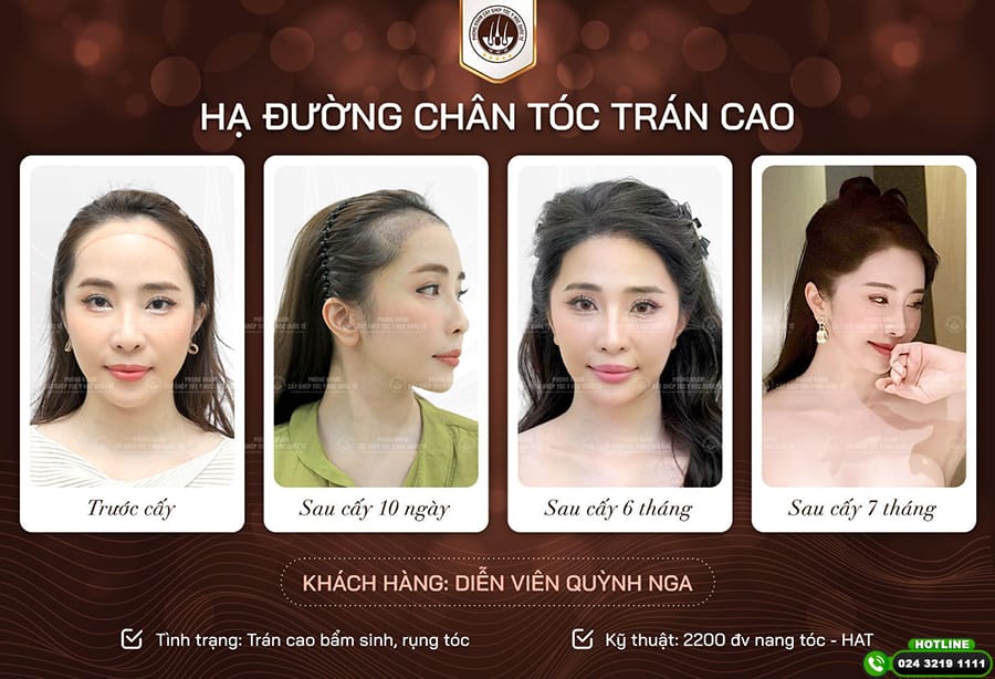 Gợi ý chọn nơi thực hiện