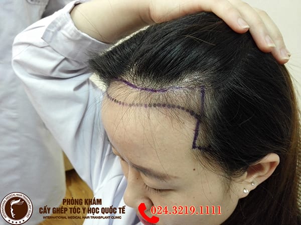 Những câu hỏi thường gặp