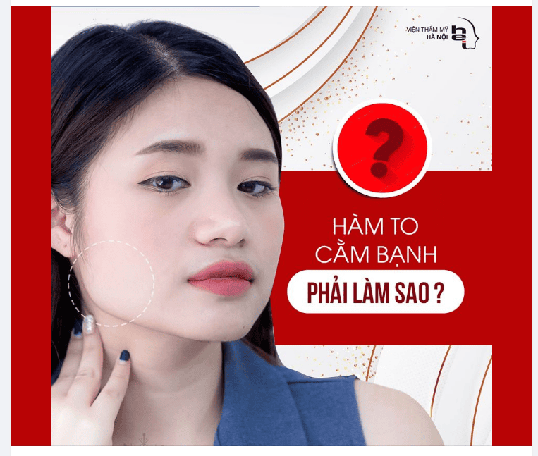 3) Phẫu thuật gọt cằm / gọt hàm V-line / chỉnh xương (surgical)