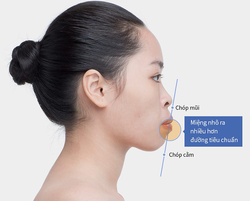 Các lựa chọn điều trị — so sánh hiệu quả và phạm vi tác động