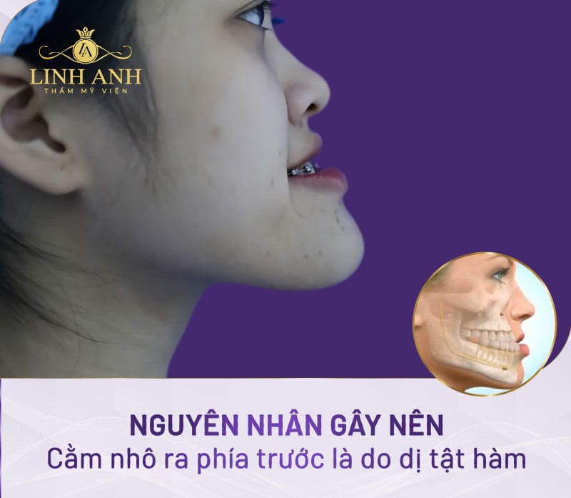 Niềng răng chỉnh nha có hiệu quả không?