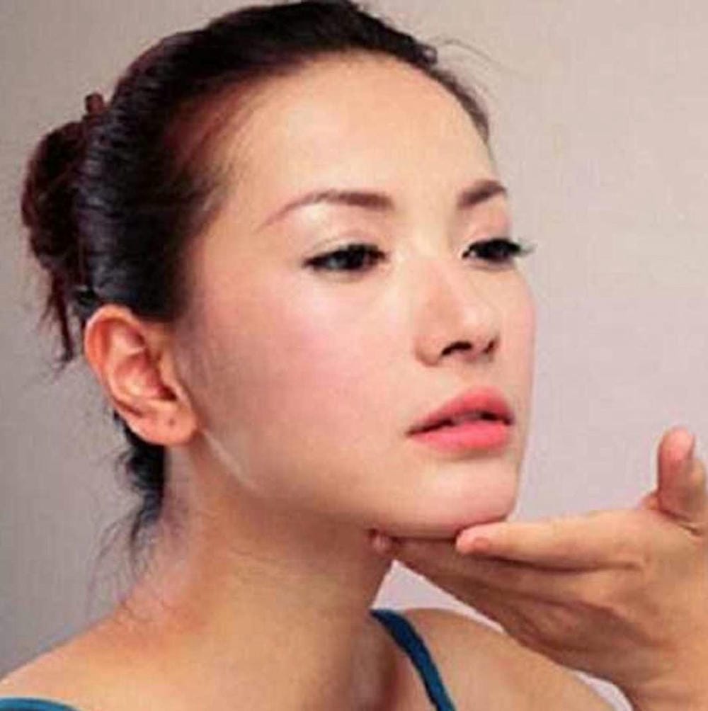 Chăm sóc sau mổ và những lưu ý để tối ưu hóa kết quả