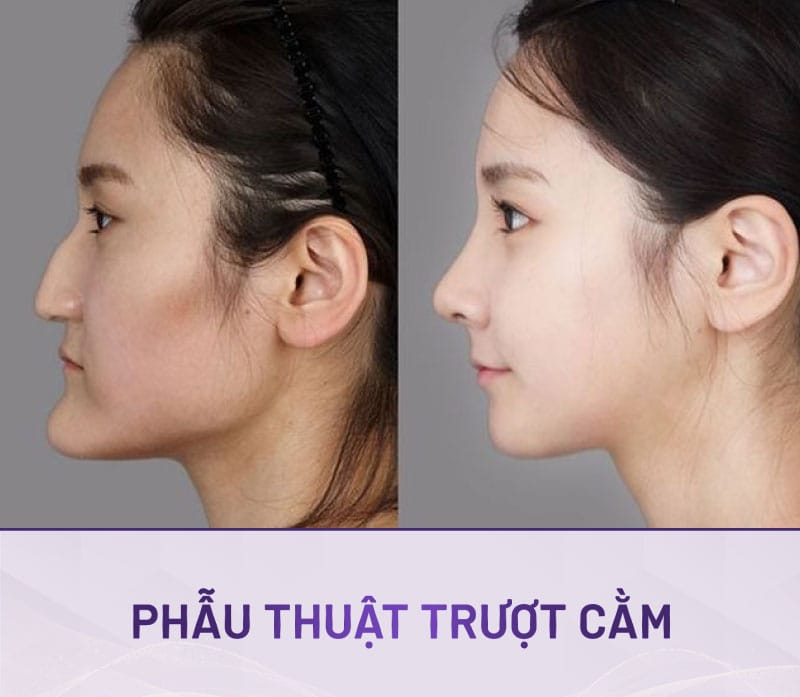 Các câu hỏi thường gặp khách hàng hay hỏi trước khi quyết định