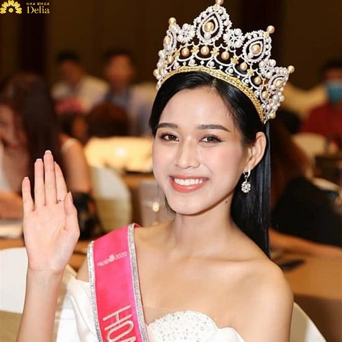Cằm chẻ có gây ảnh hưởng sức khỏe không — có nên chỉnh sửa không?