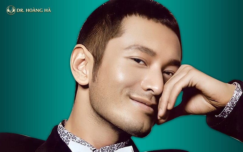 Phẫu thuật genioplasty và chỉnh cơ cho cằm chẻ — những điều cần biết
