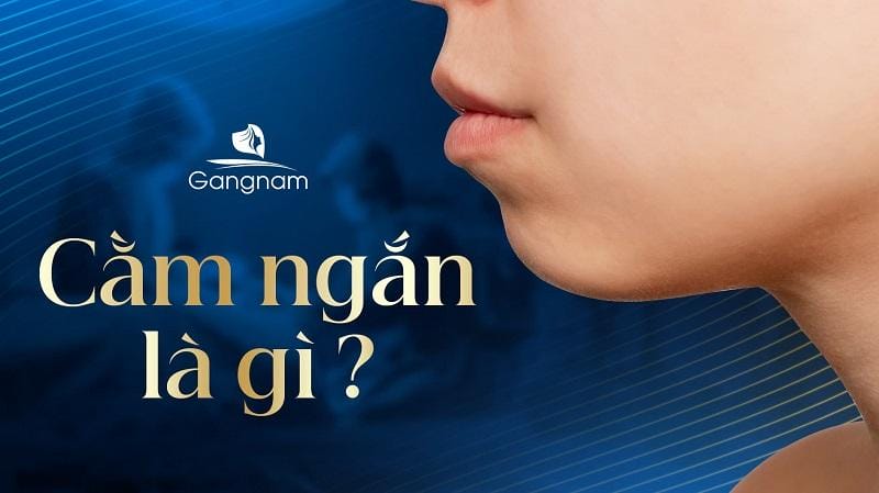 Phẫu thuật độn cằm (implant) hay chỉnh xương cằm — khi nào nên cân nhắc?