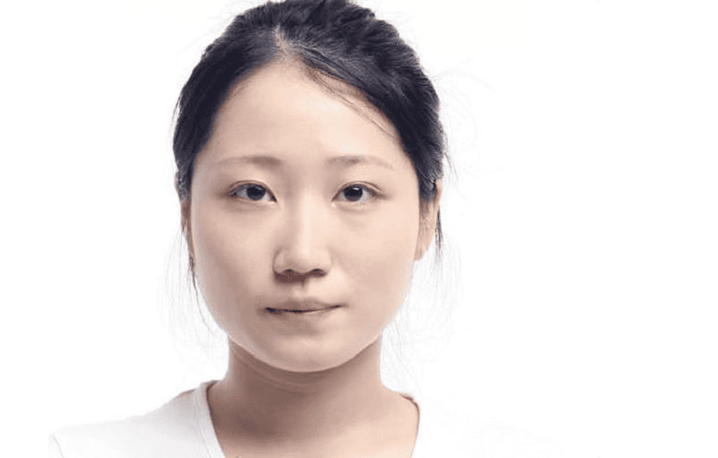 Quy trình một buổi tiêm filler cằm an toàn — bước nào bắt buộc?