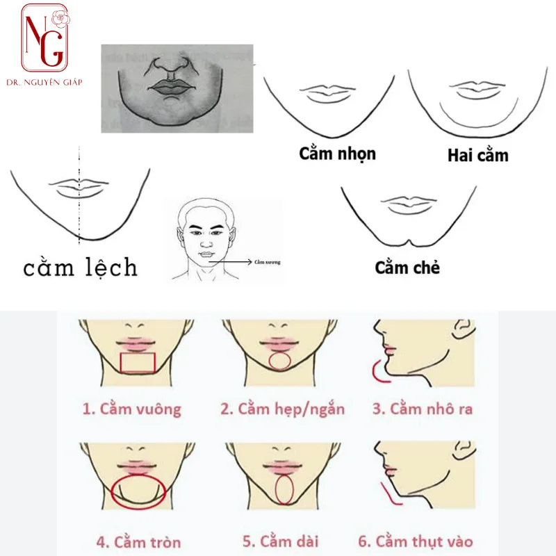 Những câu hỏi chuyên sâu về sản phẩm và lựa chọn filler
