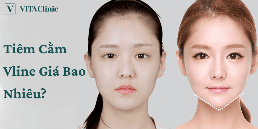 Cơ chế tác động của filler cằm (HA) và vì sao có sự khác biệt giữa các dòng?