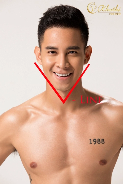 Quy trình an toàn khi thực hiện cằm V-line tại clinic — từng bước cần có