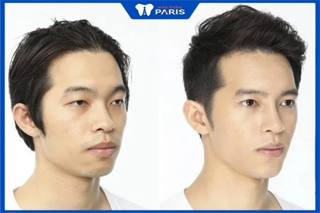 Các rủi ro, tác dụng phụ và khi nào cần gặp bác sĩ?