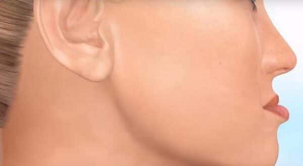 Quy trình tham vấn — bước nào cần thực hiện trước khi quyết định điều trị?