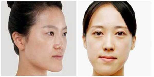 Ai phù hợp hoặc không phù hợp với mỗi phương án?