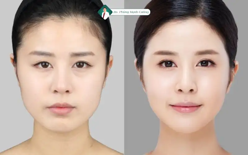 Chăm sóc sau thủ thuật: cần lưu ý gì để duy trì kết quả và giảm rủi ro?