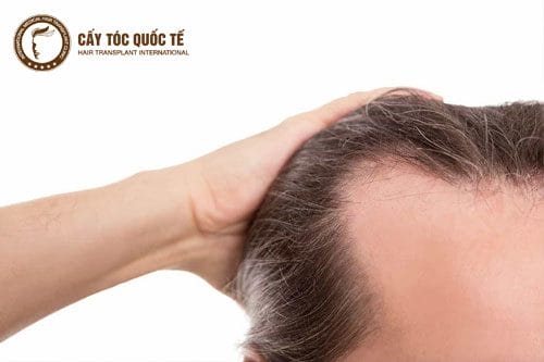 Lựa chọn cơ sở uy tín ở HCM, Hà Nội và Cần Thơ — tiêu chuẩn cần kiểm tra?