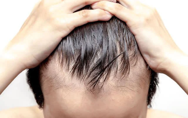 Lựa chọn cơ sở điều trị rụng tóc: tiêu chí để an toàn và kết quả hài hòa