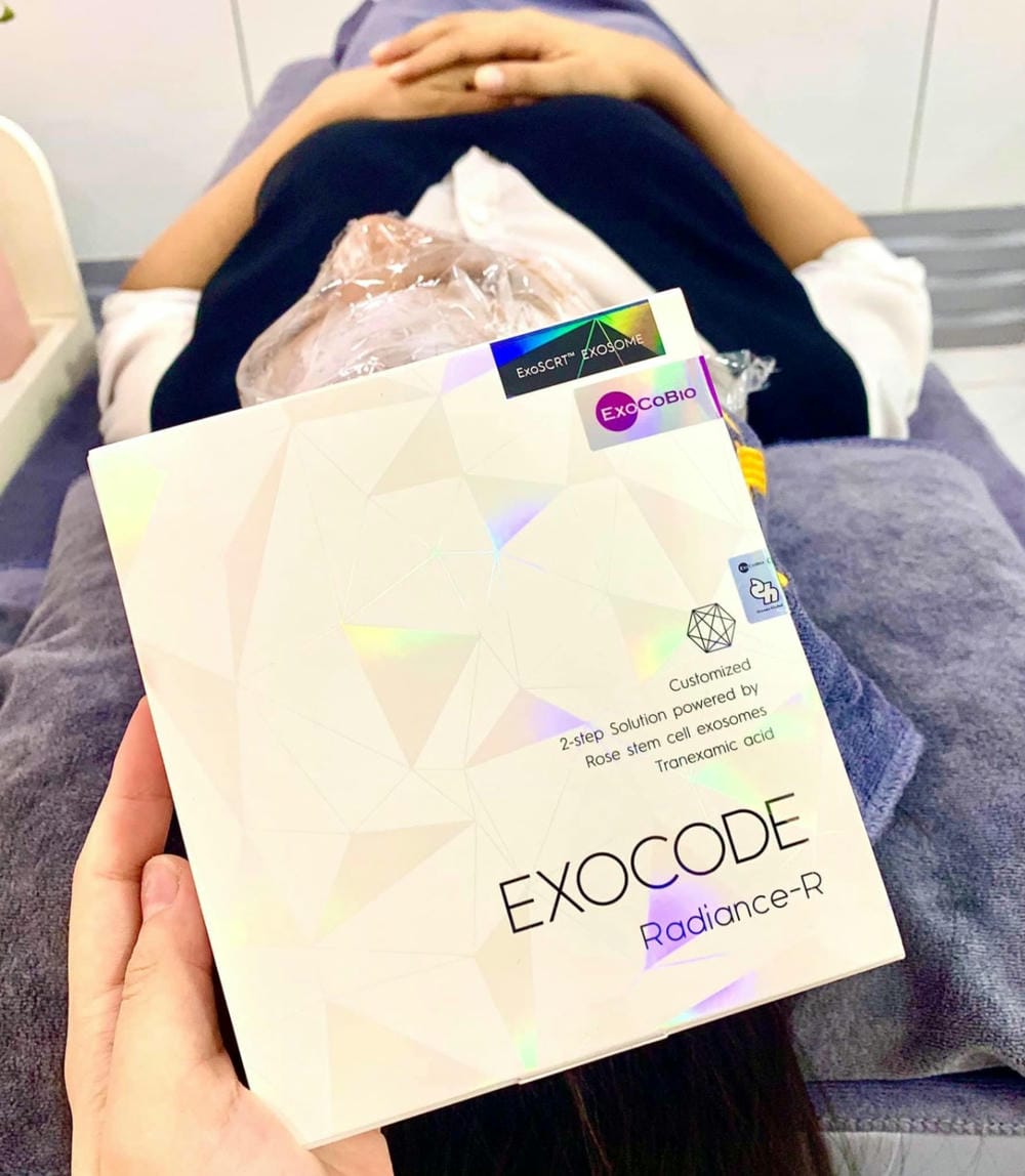 Những lưu ý quan trọng khi lựa chọn nơi cung cấp ExoCode