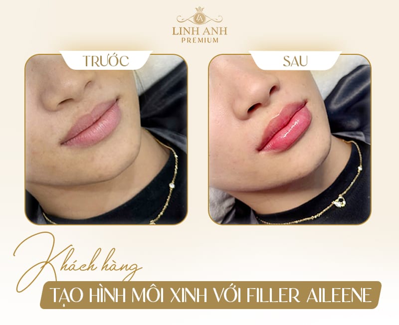 Tình trạng pháp lý tại Việt Nam và số đăng ký lưu hành
