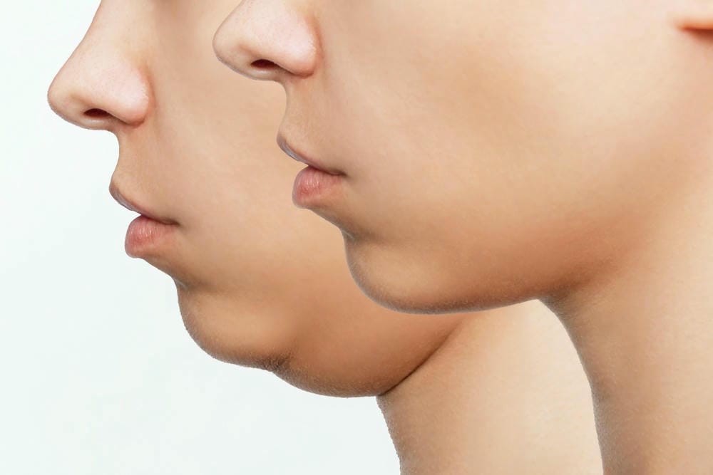 Làm sao để kiểm tra nguồn gốc và chất lượng trước khi đồng ý tiêm?
