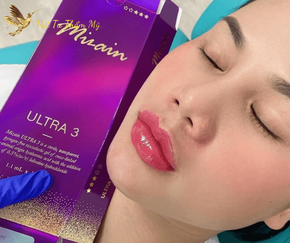 Mirain cho môi, mũi, cằm — hiệu quả duy trì bao lâu và giá tham khảo?