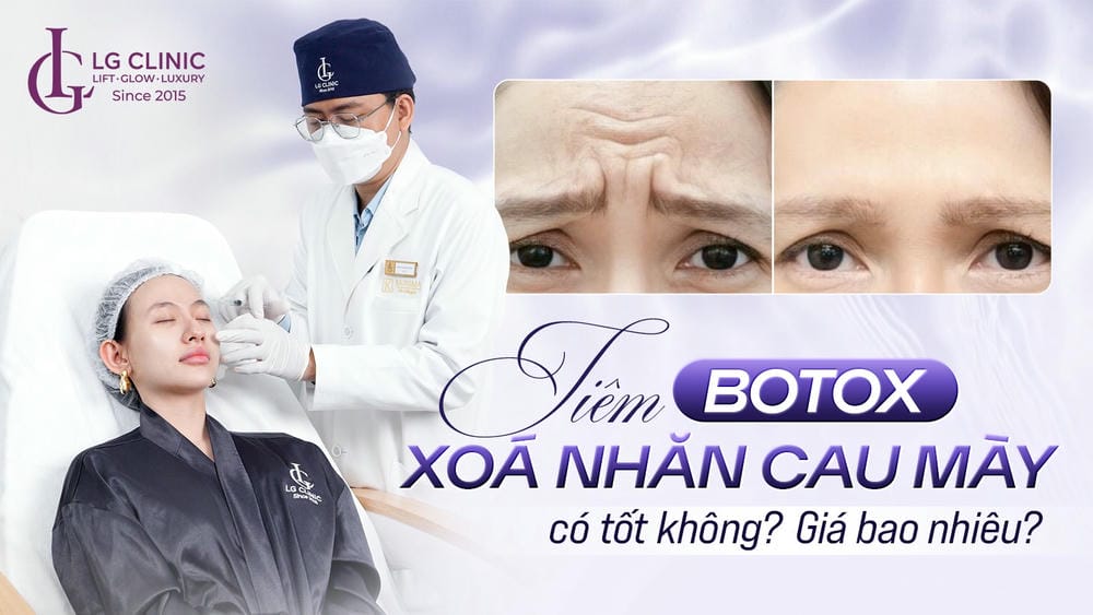 Botox tác dụng thế nào ở vùng cau mày? Cần bao nhiêu U và hiệu quả kéo dài bao lâu?