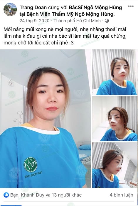 Lời khuyên cuối cùng trước khi quyết định tiêm filler nâng mũi