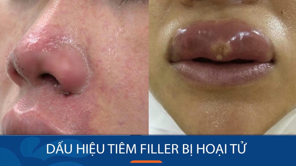 Có bằng chứng lâm sàng nào về cách giảm rủi ro và xử trí hiệu quả không?