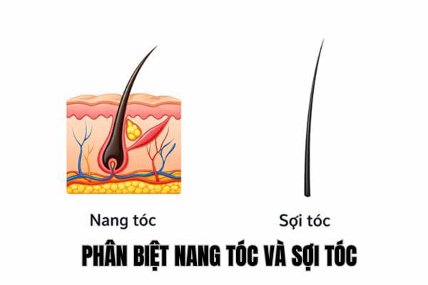 Nên chọn phương pháp điều trị nào dựa trên hình ảnh nang tóc?