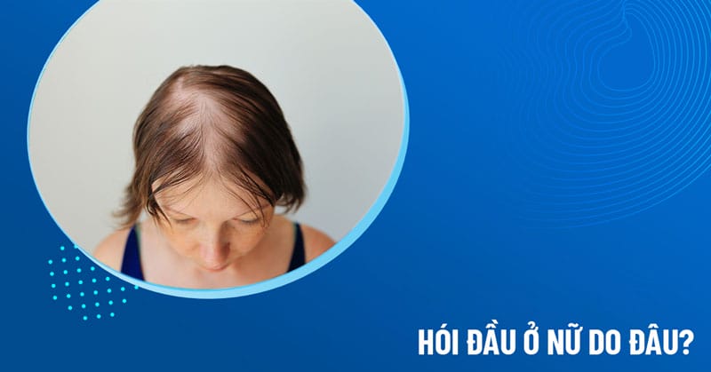 Quy trình đưa ra kế hoạch điều trị an toàn
