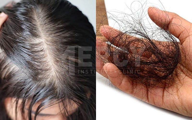 Làm thế nào chăm sóc tóc và da đầu tại nhà để hỗ trợ điều trị? — có mẹo an toàn không?