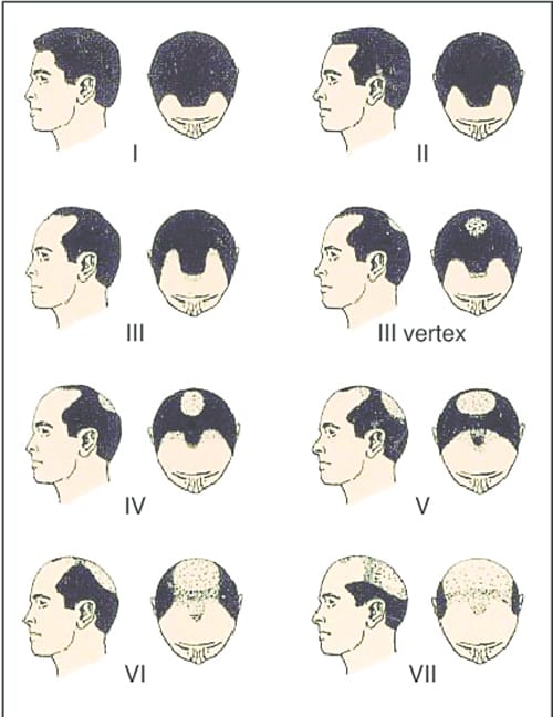 Ai phù hợp và ai không phù hợp với các phương pháp điều trị phổ biến?