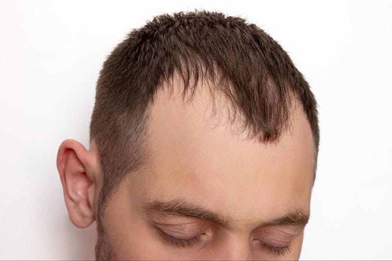Chăm sóc sau điều trị và những lưu ý quan trọng