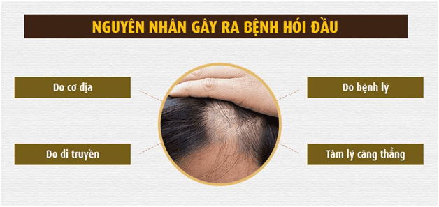 Liệu pháp bổ trợ tại chỗ: mesotherapy, minoxidil uống liều thấp, laser cường độ thấp