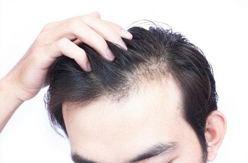 Mất bao lâu để thấy kết quả và kỳ vọng thực tế là gì?