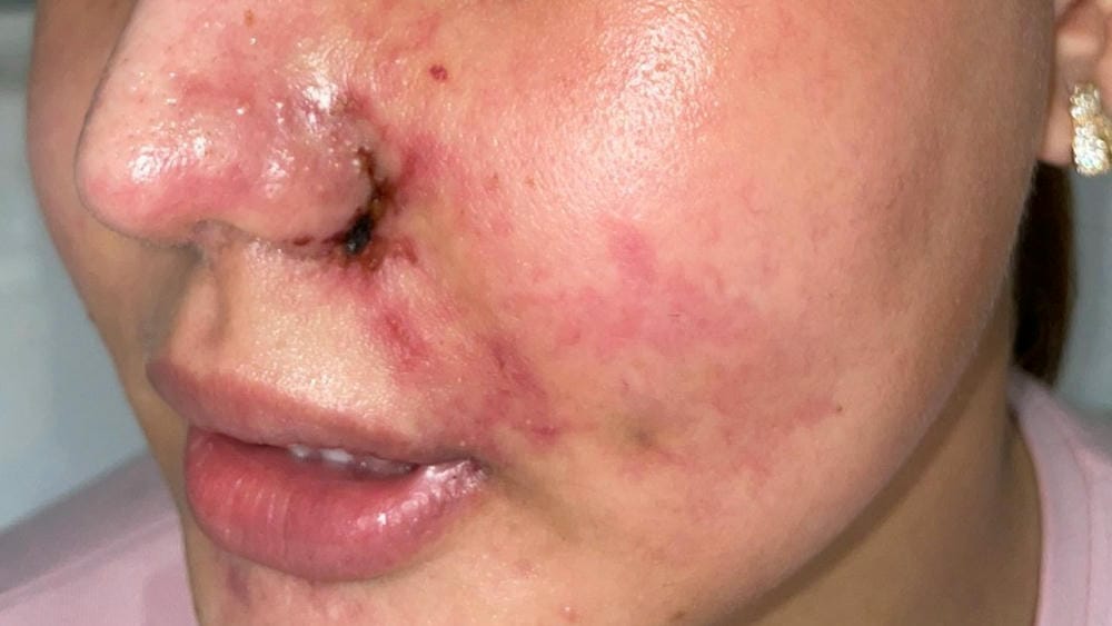 Khi nào cần đến bác sĩ hoặc bệnh viện ngay — thời hạn hành động cụ thể?