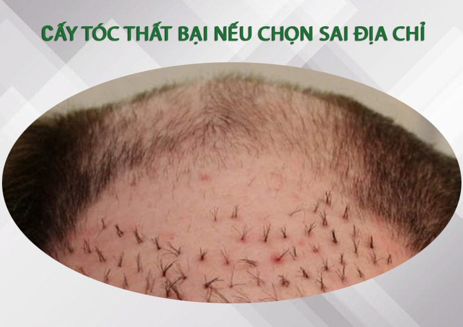Tác dụng phụ, chống chỉ định và khi nào cần gặp bác sĩ?