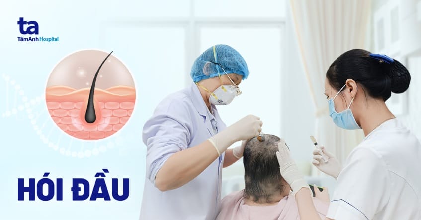 Khám hói đầu gồm những bước gì — bác sĩ sẽ làm gì khi gặp bệnh nhân?