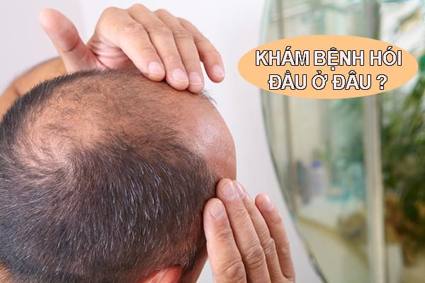 Làm thế nào để chọn nơi khám và điều trị hói đầu an toàn?
